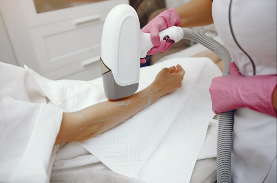 How To Prepare For Your Laser Hair Removal Blackpool Appointment