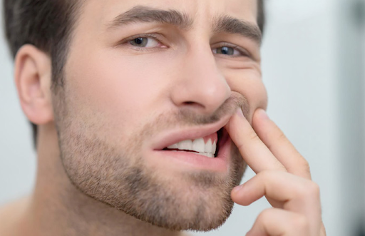 Gum Contouring: Benefits, Procedure, and Recovery Explained